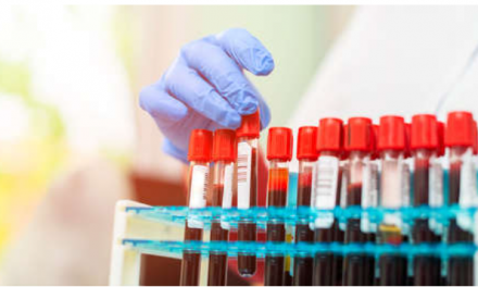 Crean el primer test de sangre que identifica simultáneamente si un paciente tiene cáncer y si se ha propagado