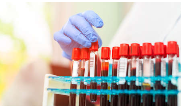 Crean el primer test de sangre que identifica simultáneamente si un paciente tiene cáncer y si se ha propagado