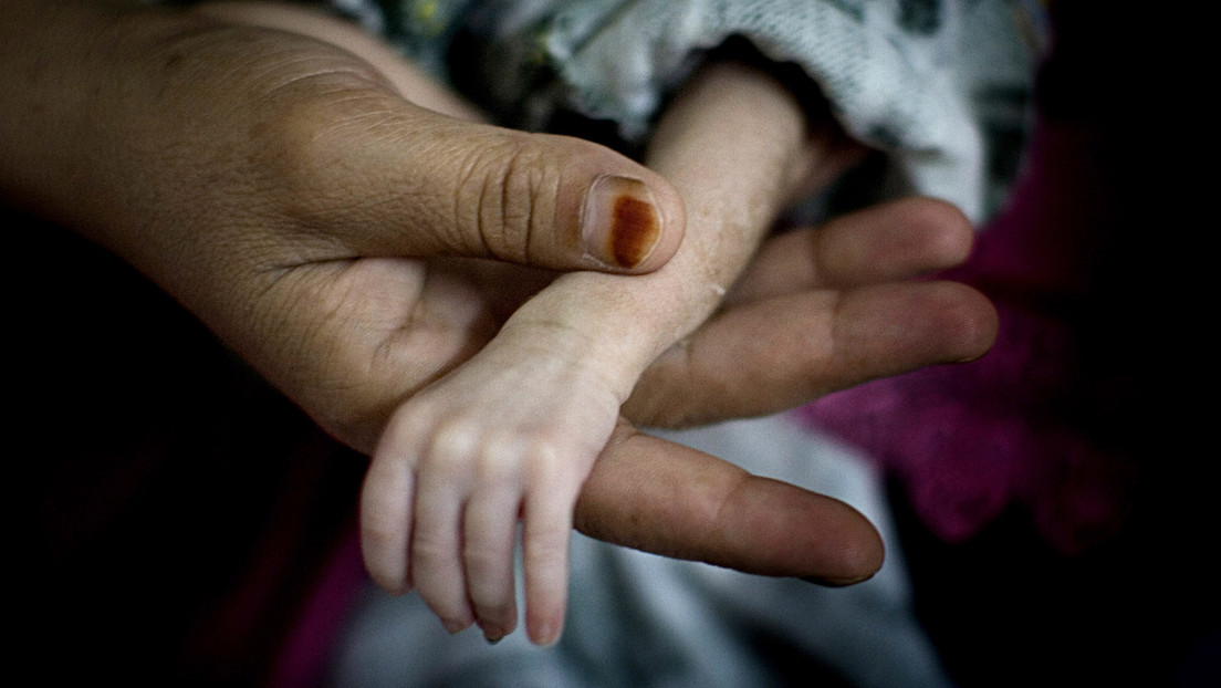 La Unicef advierte del número «catastrófico» de niños desnutridos y dice que el mundo es «un polvorín de muertes evitables» de menores