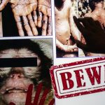 EE.UU. y Europa registran casos de la viruela del mono: ¿Qué se sabe de la enfermedad? ¿Cuán peligrosa es? ¿Hay tratamiento?